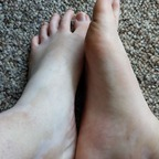 vitiligobabe profile picture